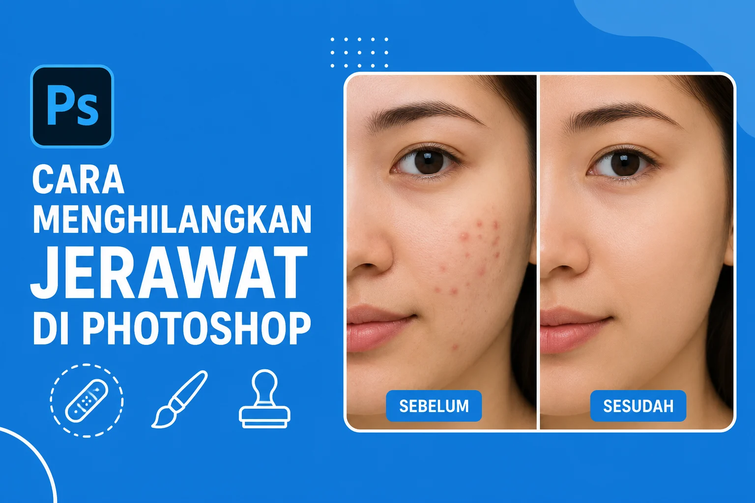 Cara Menghilangkan Jerawat di Photoshop